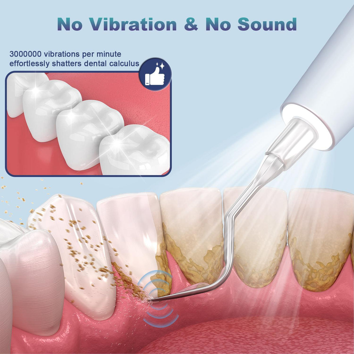 Ultrasonic Dental Plaque Remover for Humans & Pets - Professional Teeth Cleaning Kit for Tartar & Stain Removal, Safe & Gentle Electric Toothbrush for Cats, Dogs and People